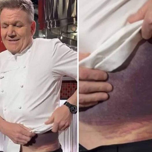 Gordon Ramsay shares important message after potentially fatal accident